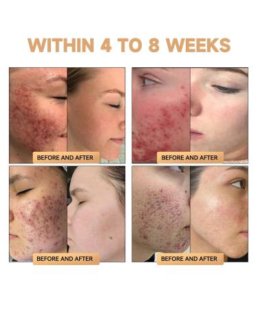 dooeka PLTOWE Super Anti-Aging Cream 2024 Latest Professional Bee Venom Treatment Cream Hydrating & Moisturizing for All Skin Types and Body Areas (2Pack) - Buy Online on GoSupps.com