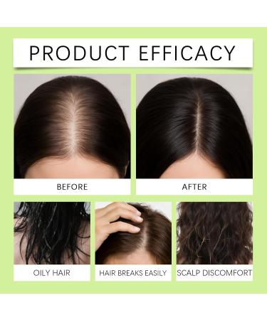 Hair Regrowth S rum de croissance des cheveux syst me de repousse des cheveux s rum de croissance des cheveux traitement avanc traitement pour plus pais renforce les racines (1 bo te) - Buy Online on GoSupps.com