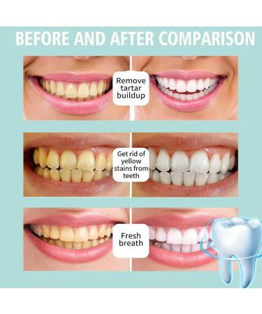 Shop Skin Menu Teeth Whitening Foam & Serum | Effective Stain Removal Toothpaste | International Shipping Available - Buy Online on GoSupps.com