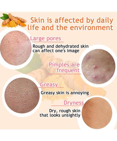 Hydrating Turmeric Face Cream | Deep Cleansing & Long Lasting Moisturizer for Face & Body - Buy Online on GoSupps.com