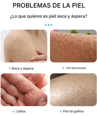 Cracked Heels Moisturizer 100g - Treatment of Callus and Dry Feet - Increase Moisture Levels Quickly Softens Hard Skin and Prevents Dryness - Buy Online on GoSupps.com