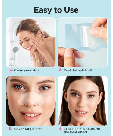 LitBear XL T-Zone Patch - 30 Patches, Hydrocolloid for Nose, Forehead, Chin, Pimple, with Tea Tree & Calendula Oil - Buy Online on GoSupps.com