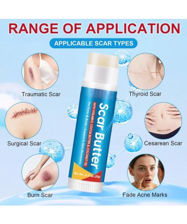 Scar Repair Stick 20g Light Butter Non Sticky | Skin Cream Removal of Scar Tissue | Hands Legs Knees Neck Burn Buttons Women Face Body - Buy Online on GoSupps.com