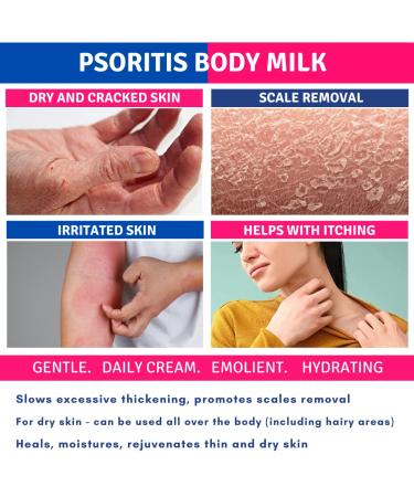 Psoritis Lotion 100ml - Urea Body Milk for Healing & Repairing Dry Itchy Skin - Seboregulating Cream for Hands Feet Body & Face - Buy Online on GoSupps.com