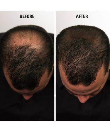 Infinity Hair Fiber - Hair Loss Concealer for Men & Women - Dark Brown 30g - Buy Online on GoSupps.com