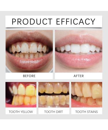 Mint Toothpaste - Daily Oral Care for Tartar Removal Bad Breath Relief Long-Lasting Fresh & Gradual Teeth Brightening(3PCS) - Buy Online on GoSupps.com