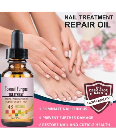 Fungal Nail Treatment - Toe Nail Fungal Treatment - Nail Fungus Treatment for Toenail and Fingernails - Anti fungus Nail Repair and Strengthen Fix & Renew Damaged Broken Nails - Buy Online on GoSupps.com
