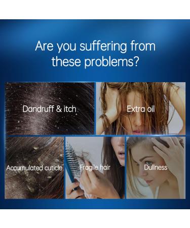 EUBEISAQI Braid Spray for Itchy Scalp Hair Moisturizing Spray Scalp treatment for easy application adjust water and oil balance moisturize hair and scalp hair - Buy Online on GoSupps.com