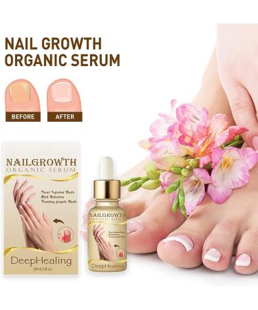 NailGrowth DeepHealing Organic Serum NailGrowth Nail Serum Reconstrux Nail Growth Nail Growth and Strengthening Serum Nail Serum for Growth and Repair for Damaged Nails (1PC) - Buy Online on GoSupps.com