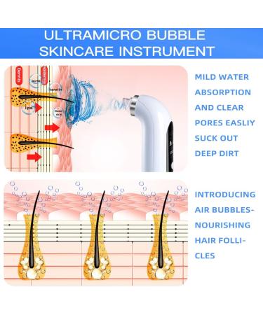 Portugalies Rechargeable Blackhead Remover Pore Vacuum - 3 Suction Modes, 6 Probes - Buy Online on GoSupps.com