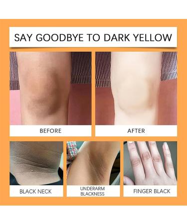 JUFKGBAR Vitamin C Time Body Cream Vitamin C Whitening Body Lotion Natural Moisturizing Anti-Dark Circles Toning Cream for Body Face and Uneven Skin Tone - Buy Online on GoSupps.com