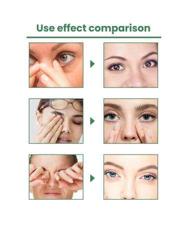 Ball Eye Care Massage Device for Dry Eyes & Fatigue Relief - A2 Pink | International Shipping - Buy Online on GoSupps.com