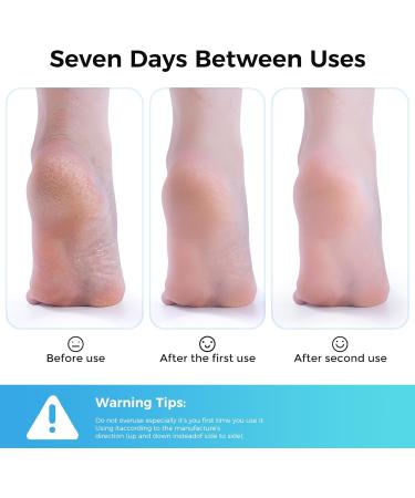 Professional Stainless Steel Foot File Callus Remover & Foot Scrubber for Smooth Feet - Pedicure Tool for Women - Buy Online on GoSupps.com