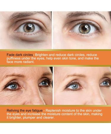 Vitamin C Eye Balm for Dark Circles - Retinol Eye Serum | Hydrating Eye Treatment (1pcs - Buy Online on GoSupps.com