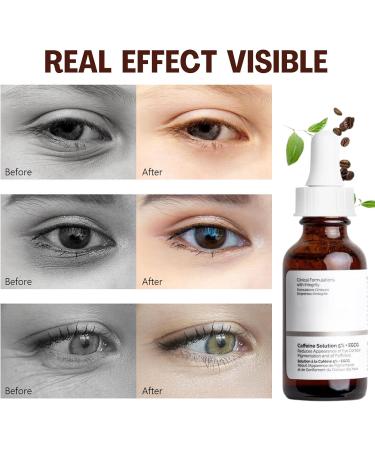 Caffeine Solution 5% + EGCG Eye Serum | Dark Circle & Puffiness Reducing Anti-Aging Eye Cream - Buy Online on GoSupps.com