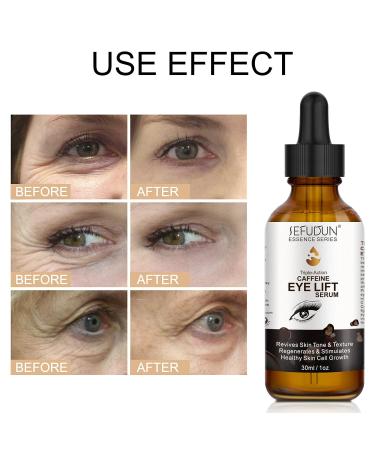 Caffeine Eye Serum with EGCG Vitamin C & Hyaluronic Acid | Revitalize & Refresh Your Eyes - Buy Online on GoSupps.com