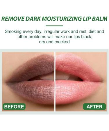 Lip Balm | Lip Lightening For Dark Lips | Organic Lip Lightening Balm | Nourishing Lip Bleaching Cream Care Repair & Protection - Buy Online on GoSupps.com