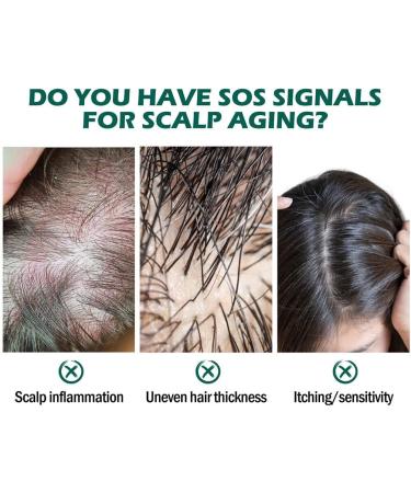 Allayu Adults Dense Hair Growth Essential Oil Natural Ingredient Regrowth Follicle Repair Essence Serum Beauty Supplies - Buy Online on GoSupps.com