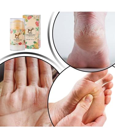 Stick Cr me Anti-Fissures Pieds | Cr me R paratrice Talon Fissur Homme - Soin Podologique Non Gras pour Femme Homme Adolescents Grands-parents | pour Femme Ado Jeune et Grands-Parents - Buy Online on GoSupps.com