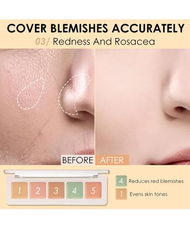 Focallure Color Correcting Concealer Palette - 5 Colors Camouflage Contour Palette for Dark Circles, Blemishes, and Redness - Buy Online on GoSupps.com