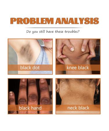 Fulvtuy JAYSUING Acanthosis Nigricans Therapy Oil - Reduces Dark Spots, Soothes Skin - 5 Pack - Buy Online on GoSupps.com