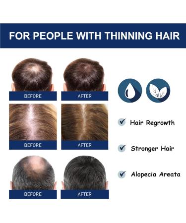 Kanoauo Hair Growth Cream 20 g regrowth cream strengthens the roots promotes scalp health and restores hair growth accelerates hair growth - Buy Online on GoSupps.com