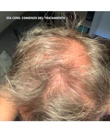 HEY JOE! - Power Hair Lotion | Anti-hair loss lotion formulated with plant stem cells Cruelty Free and vegan - 150 ml - Buy Online on GoSupps.com