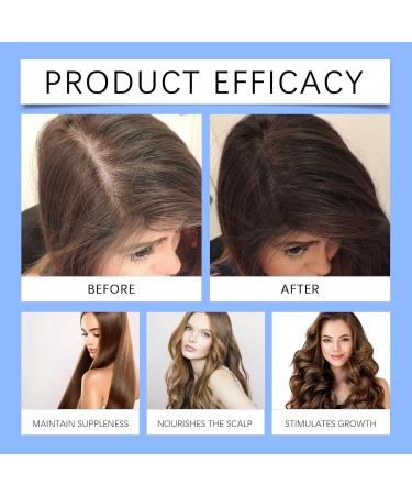  Generisch Advanced Copper Peptide Serum - Copper Peptide Hair Growth Serum - 30 ml (1st Pack) for Men and Women - Blue - Unisex - All Hair Types - Buy Online on GoSupps.com