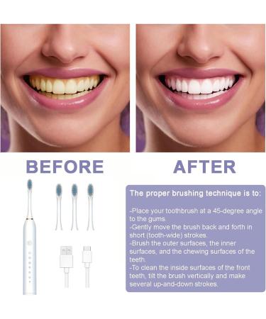 Sonic Electronic Toothbrush - 6 Modes & Smart Timer | Effective Teeth & Gum Cleaning for Men & Women - White - Buy Online on GoSupps.com