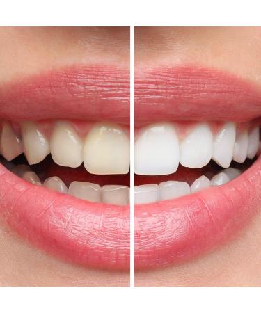  President President Set of 6 White Teeth Whitening Anti-Plaque Anti-Scales and Anti-Yellowing Teeth Refreshing with RDA 85 Piedmontese Mint Aroma 6 x 75 ml - Buy Online on GoSupps.com