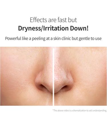 Benton Glycolic Acid 7% Exfoliating Toner with Niacinamide - Gentle AHA Toner for Brighter Skin & Even Tone - Balances Oil & Moisture - Hydrating Cruelty-Free Korean Skin Care - Buy Online on GoSupps.com