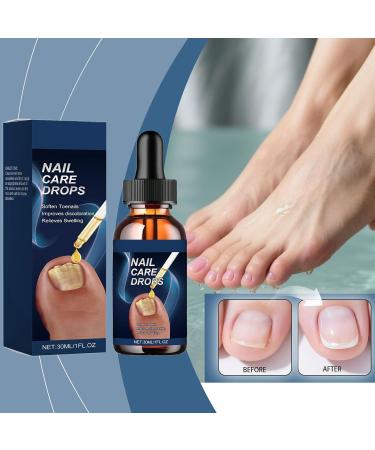  Jingmiger Nail Care Products | 15ml Nourishing Liquid - Nail Care Drops For Dryness Redness Thickening Women's and Men's Home Manicure Salon Pedicure Preparation - Buy Online on GoSupps.com