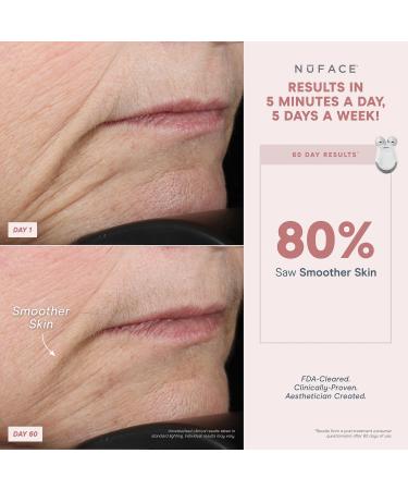 NuFACE Mini & FIX Starter Kits - FDA Cleared Microcurrent Device for Face Sculpting & Line Smoothing - Aqua Gel & FIX Serum Included - Buy Online on GoSupps.com