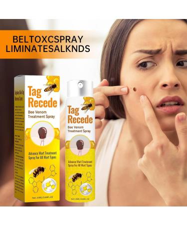 Beauty Grain Removal - Anti-Skin Spray | Fast Acting Natural Liquid with Plant Extracts 20ml Painless Skin Lightening for Back Legs Hands Feet - Buy Online on GoSupps.com