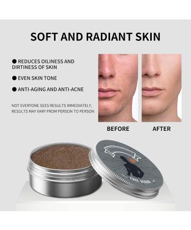 Norse Organics Acne Killer Set | Acne Balm & Clearing Cream for Teens & Adults | Skin Nourishing Treatment for Acne & Redness Relief - Buy Online on GoSupps.com