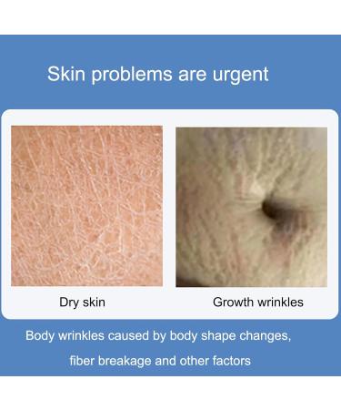 VolksRose Abdomen Lift Tapes - Anti-Wrinkle Silicone Patches for Sagging Skin Reusable Tummy Sculpting Pads Smooths Belly Wrinkles | International Shipping Available - Buy Online on GoSupps.com