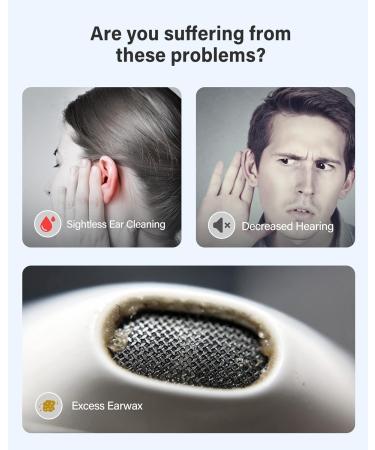 Xlife Wireless Ear Camera & Earwax Remover with 1080P HD, Blackhead Remover Kit - iPhone, iPad, Android - R1 White - Buy Online on GoSupps.com