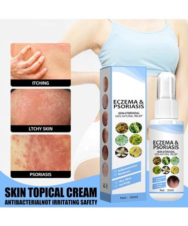 Meellop Herbal Psoriasis Relief Spray - Dermax Psoriasis Treatment for All Skin (1) - Buy Online on GoSupps.com