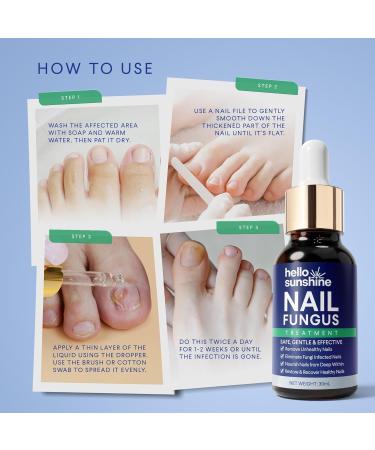 Toenail Fungus Treatment Extra Strength - Fast-Acting Nail Renewal Liquid for Damaged & Discolored Nails (1 FL OZ) - Shop Now for Effective Relief - Buy Online on GoSupps.com