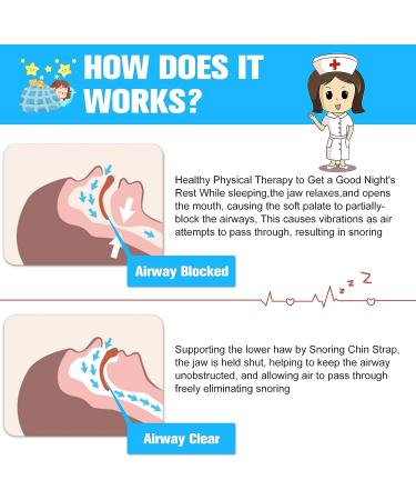 Adjustable Anti Snoring Chin Strap for Men and Women - Stop Snoring Solution for Better Sleep - Buy Online on GoSupps.com