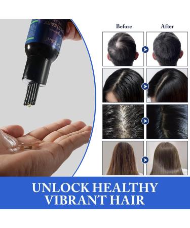 Rosemary Essential Oil for Hair Growth - 120ml Pure Organic Infusion with Castor Oil | Scalp Massage & Body Care Improves Circulation & Reduces Hair Loss - Buy Online on GoSupps.com