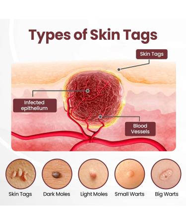 TLOPA KeraErase Dual-Action Renewal Cream Professional Black and White Rice Soothing Repair Cream Face Moisturizer - Improves Moisture Skin Barrier for All Skin Types (1) - Buy Online on GoSupps.com