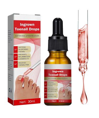 Professional Ingrown Toenail Treatment Drops | Easy Trimming & Softening | Pin Reduction | 30ml - Buy Online on GoSupps.com