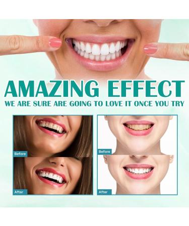 Toothpaste Cleaning Foam 250ml | Intensive Stain Removal & Brightening Formula for Perfect Smile - Buy Online on GoSupps.com