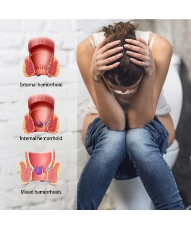 Hemorrhoid Relief Cream: Fast Pain and Itch Relief for Piles - Soothes Swelling and Burning Discomfort - Buy Online on GoSupps.com