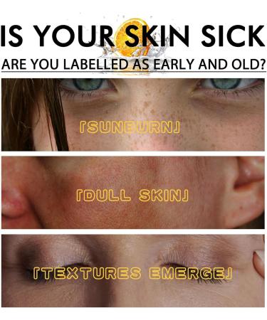 BAInuai Melanine Correcting Essential Oil Dark Spot Correcting Serum Whitening Speckle Thinning Essential Oil Melanine Correcting Facial Serum Hyperpigmentation Correcting Facial Serum 1 stuk 1 stuks - Buy Online on GoSupps.com