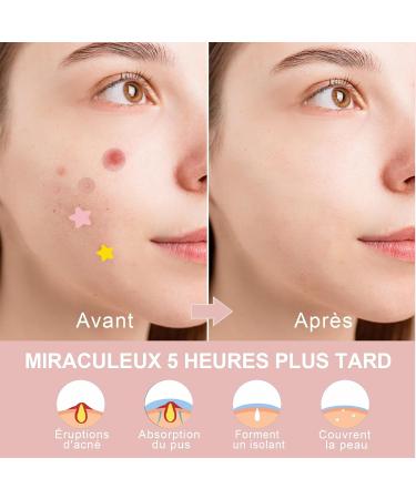 VEGCOO 272 Pi ces Patch Bouton Pimple Patches Patch Anti Bouton d'Acn Pansement Hydrocollo de Imperm able et Hydratant pour Favoriser la Gu rison de l'Acn  - Buy Online on GoSupps.com