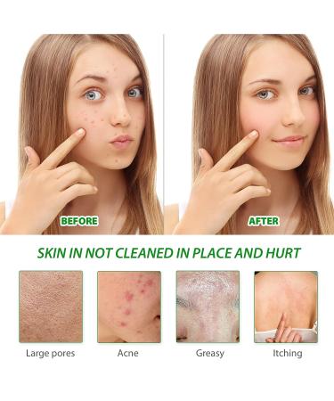 2PCS Organic Ginger Soap for Lymphatic Detox & Drainage - Slimming Soap for All Skin Types - Buy Online on GoSupps.com