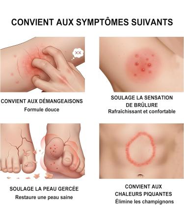 Cr me antifongique pour la peau : Cr me antifongique pour le pied d'athl te les d mangeaisons et la teigne - Formule douce - Convient aux pieds et au corps (18G 1-Pack) Vert - Buy Online on GoSupps.com