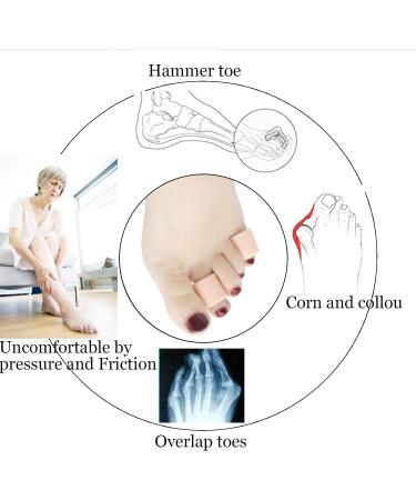 5 Pairs Gel Open Toe Sleeves | Toe Protectors for Hammer Toes Ingrown Toenails & Corns - Best Cushion & Splint for Friction Relief - Buy Online on GoSupps.com